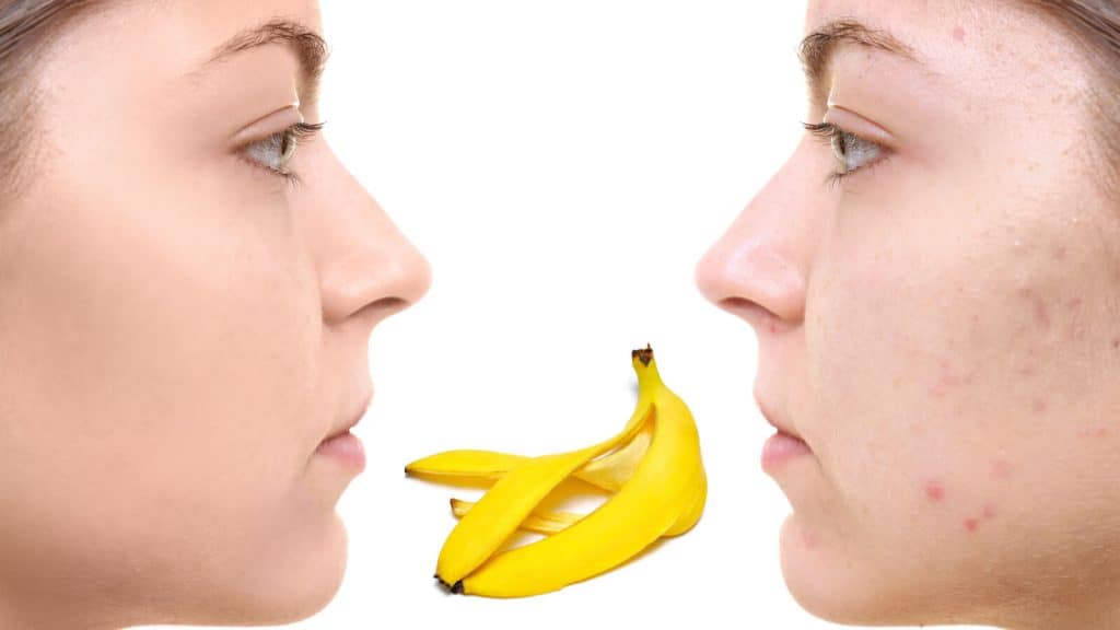 How to Use Banana Peels to Enhance Facial Beauty?