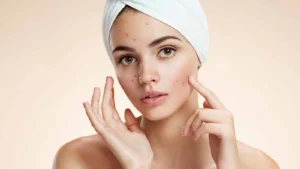 Top Tips on How to Get Rid of Dark Spots on Face Naturally